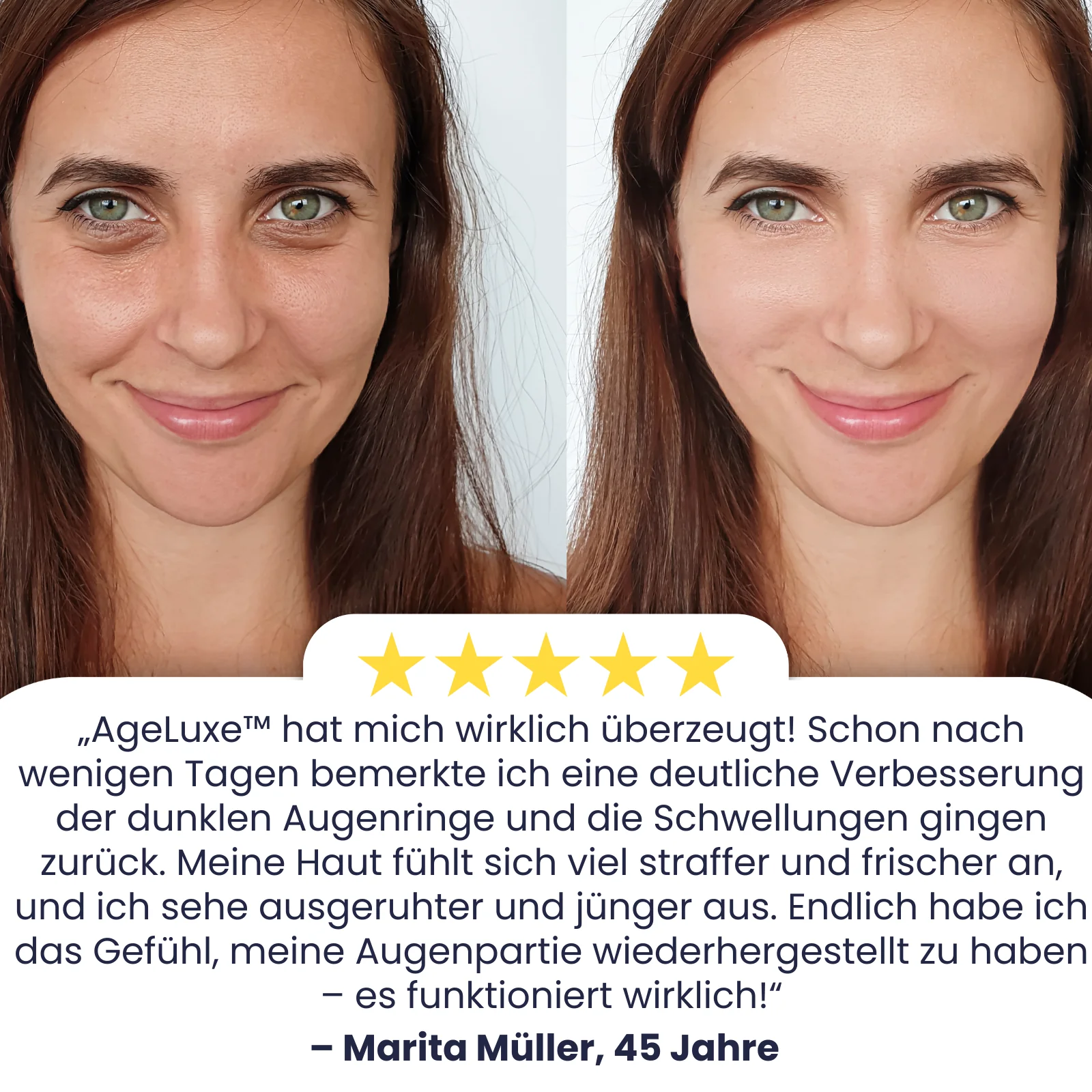 AgeLuxe™ | Bekämpfe dunkle Augenringe! - Image 3