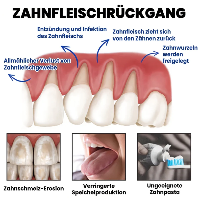 Balancia™ | Bienengift gegen Zahnfleischrückgang - Image 4