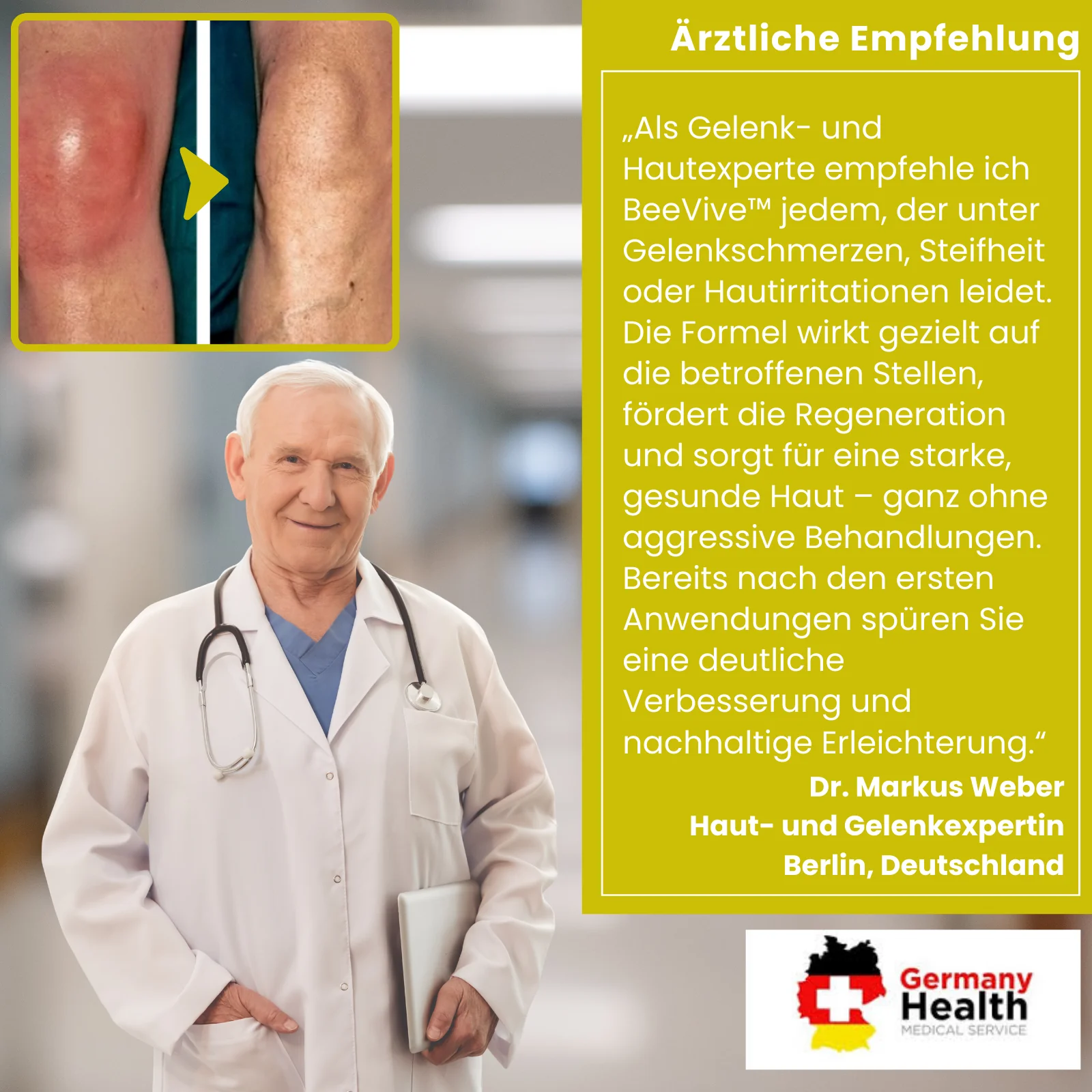 BeeVive™ Creme | Spüren Sie einen Unterschied von 97% in nur 7 Tagen! - Image 2