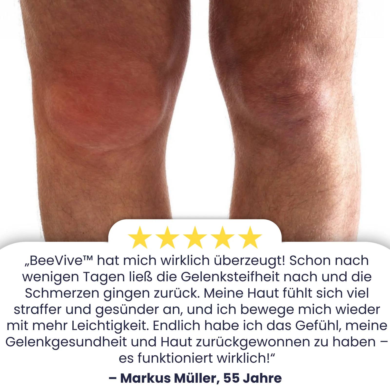 BeeVive™ Creme | Spüren Sie einen Unterschied von 97% in nur 7 Tagen! - Image 3