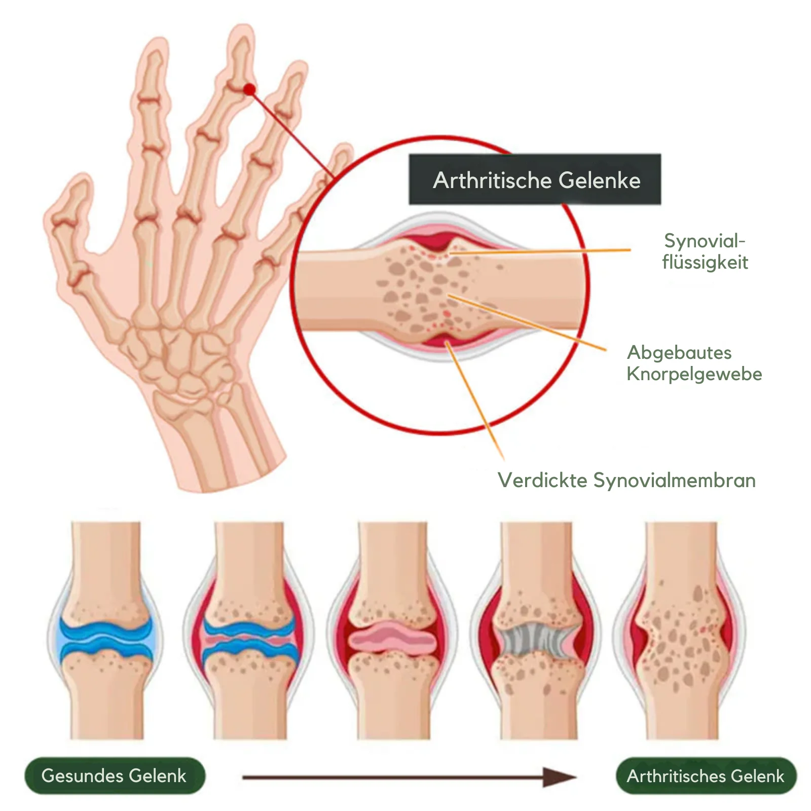 BoneFlex™ | 95% Flexibilität in 7 Tagen! - Image 5