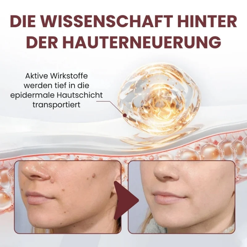 BumpAway™ | Botanische Warzen-Creme - Image 10
