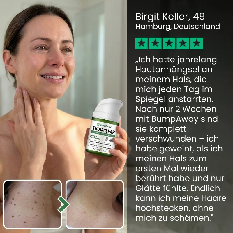 BumpAway™ | Botanische Warzen-Creme - Image 4