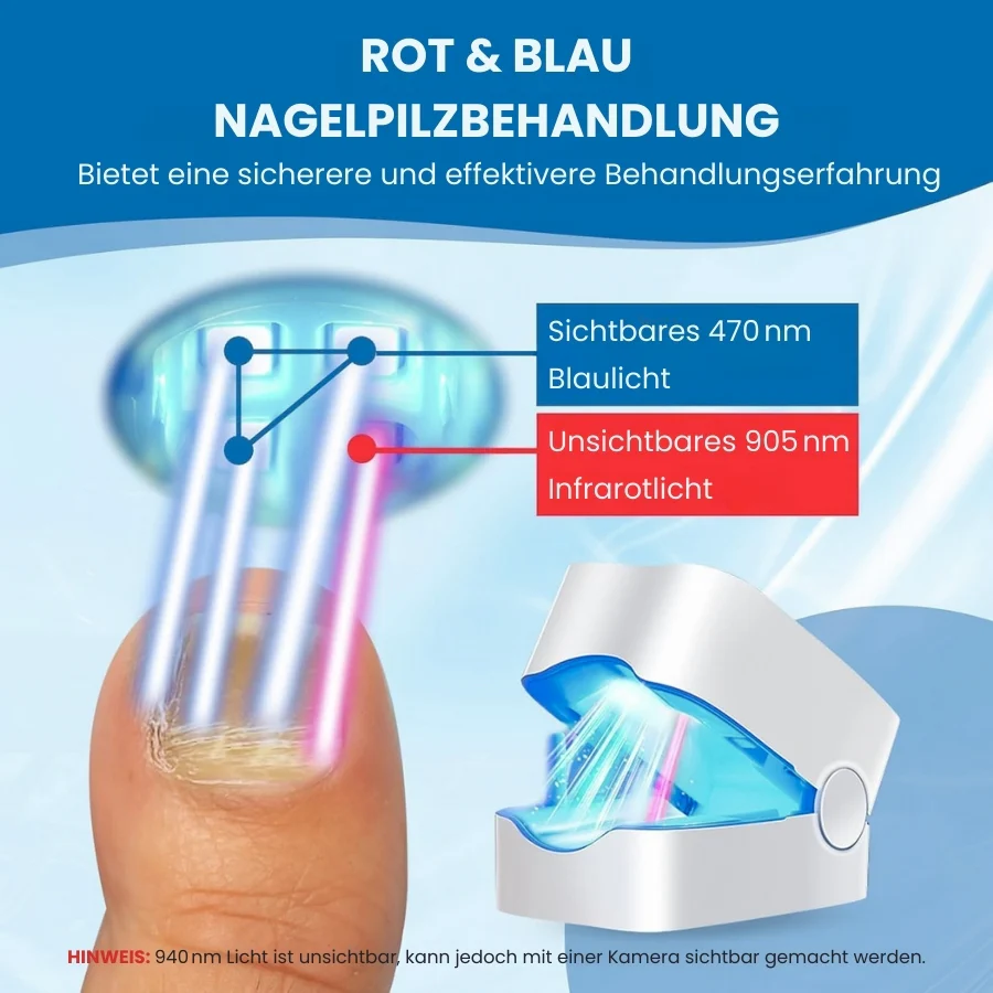 ClearNail Pro™ | Nagelpilz-Lasergerät - Image 5
