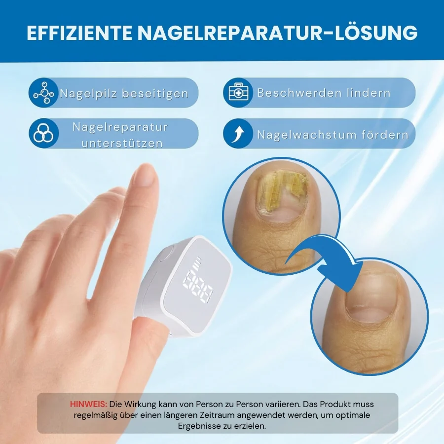 ClearNail Pro™ | Nagelpilz-Lasergerät - Image 6