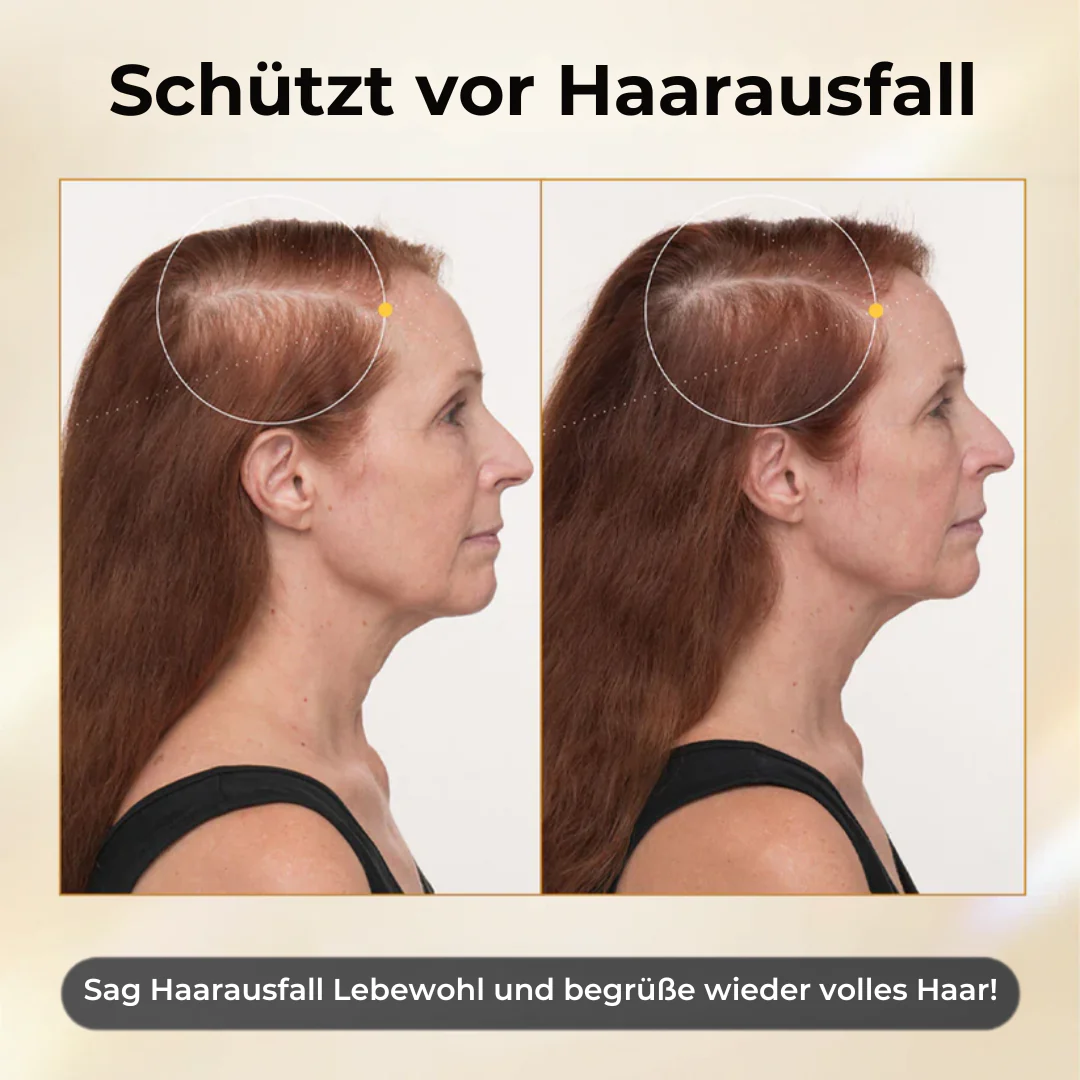 CollagenGrow™ | Haarwuchsspray - Image 4