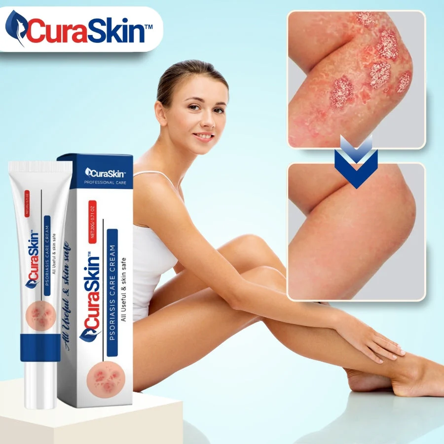 CuraSkin™ | Psoriasis- und Ekzem-Creme - Image 11