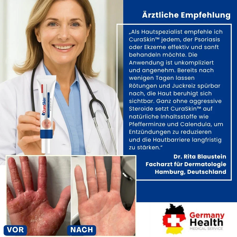 CuraSkin™ | Psoriasis- und Ekzem-Creme - Image 6