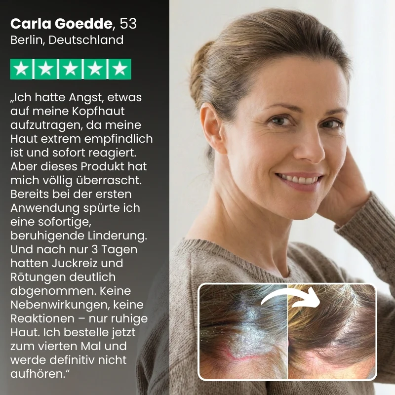 DermaCalm™ | Natürliche Linderung bei juckender Kopfhaut oder Haut - Image 4