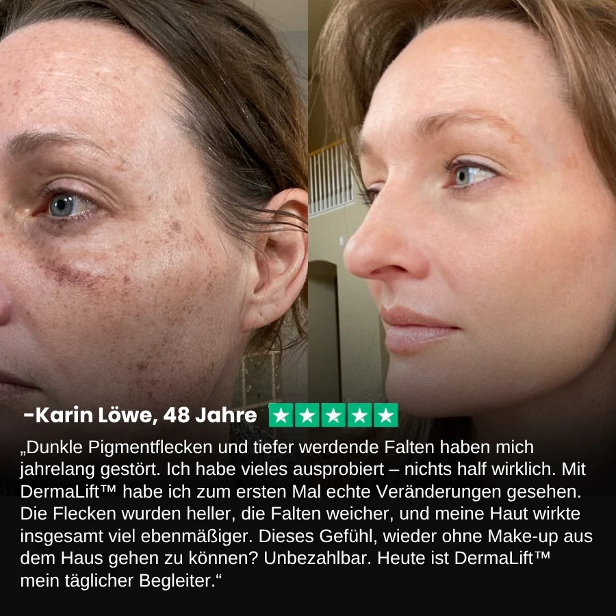 DermaLift™ | Straffender Talg-Honig-Balsam gegen Falten - Image 7