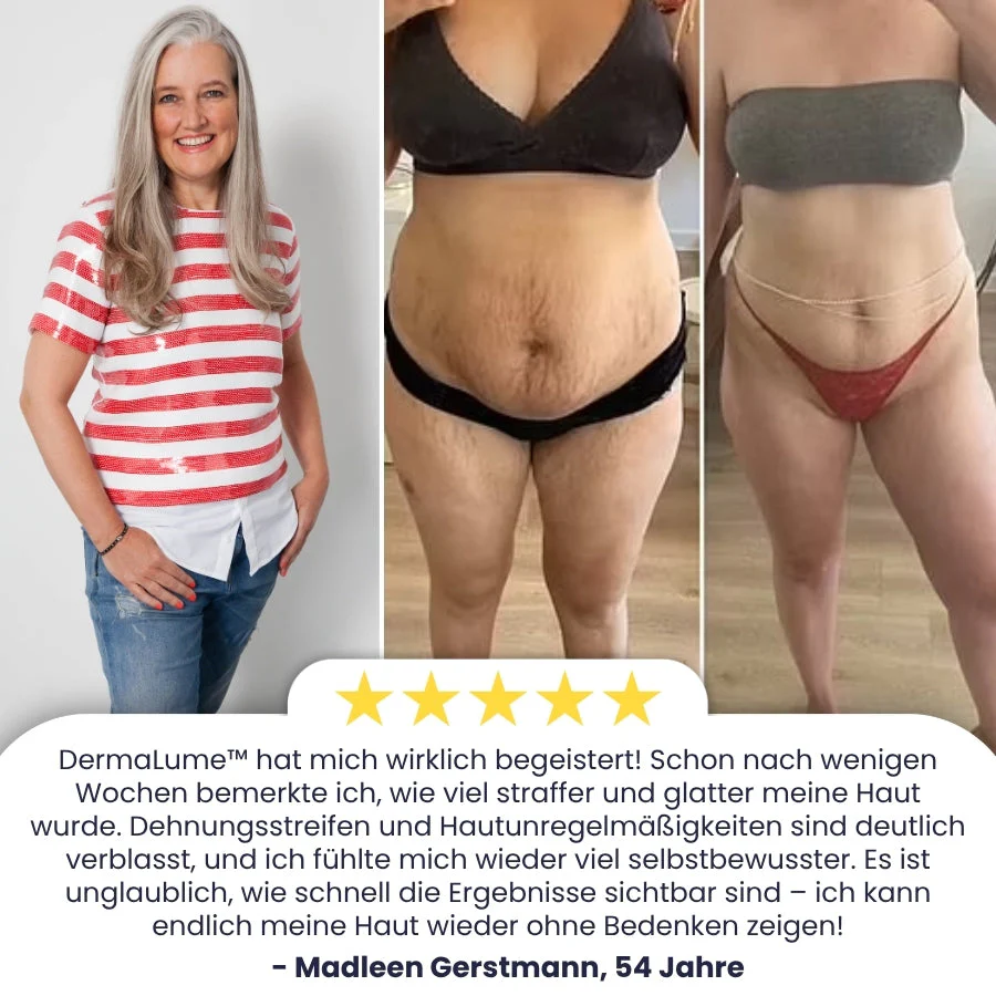 DermaLume™ | Retinol Anti-Aging Körpercreme - Image 5