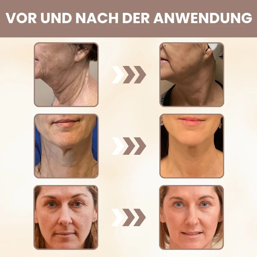 DermaPure™ | 15-Stunden-Lifting für das Gesicht - Image 7