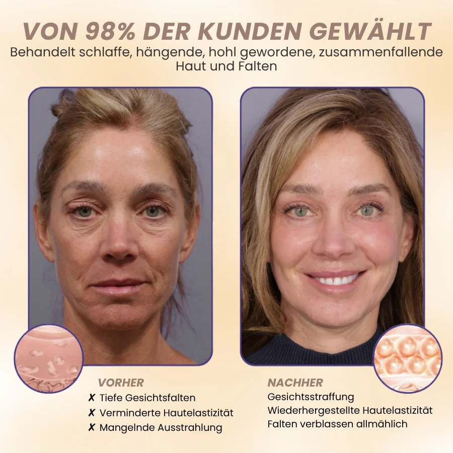 DermaPure™ | 15-Stunden-Lifting für das Gesicht - Image 8