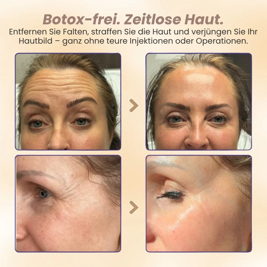 DermaPure™ | 15-Stunden-Lifting für das Gesicht - Image 9