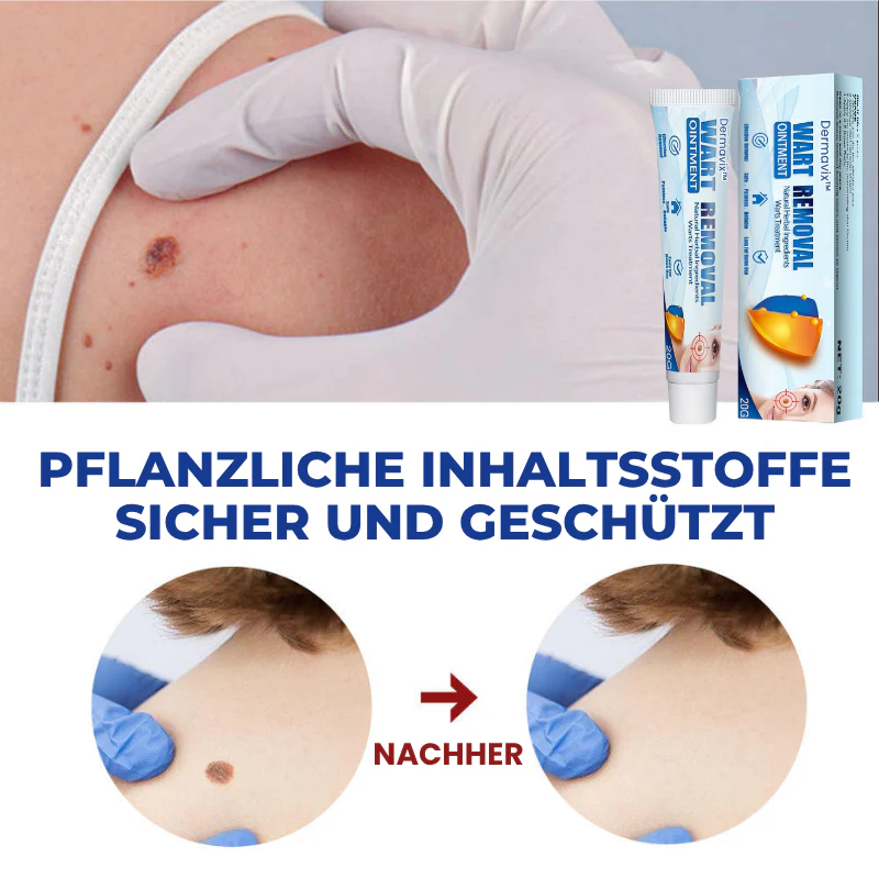 Dermavix™ | Entfernt 97% der Warzen & Hauttaggen in nur 3 Tagen! - Image 8