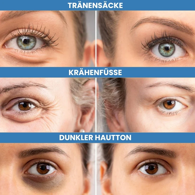 Dermxell+ | Sofort wirkende Augenlifting-Creme - Image 6