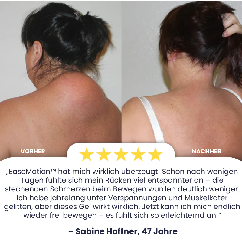 EaseMotion™ | Curcumin-Schmerzlinderungsgel - Image 3