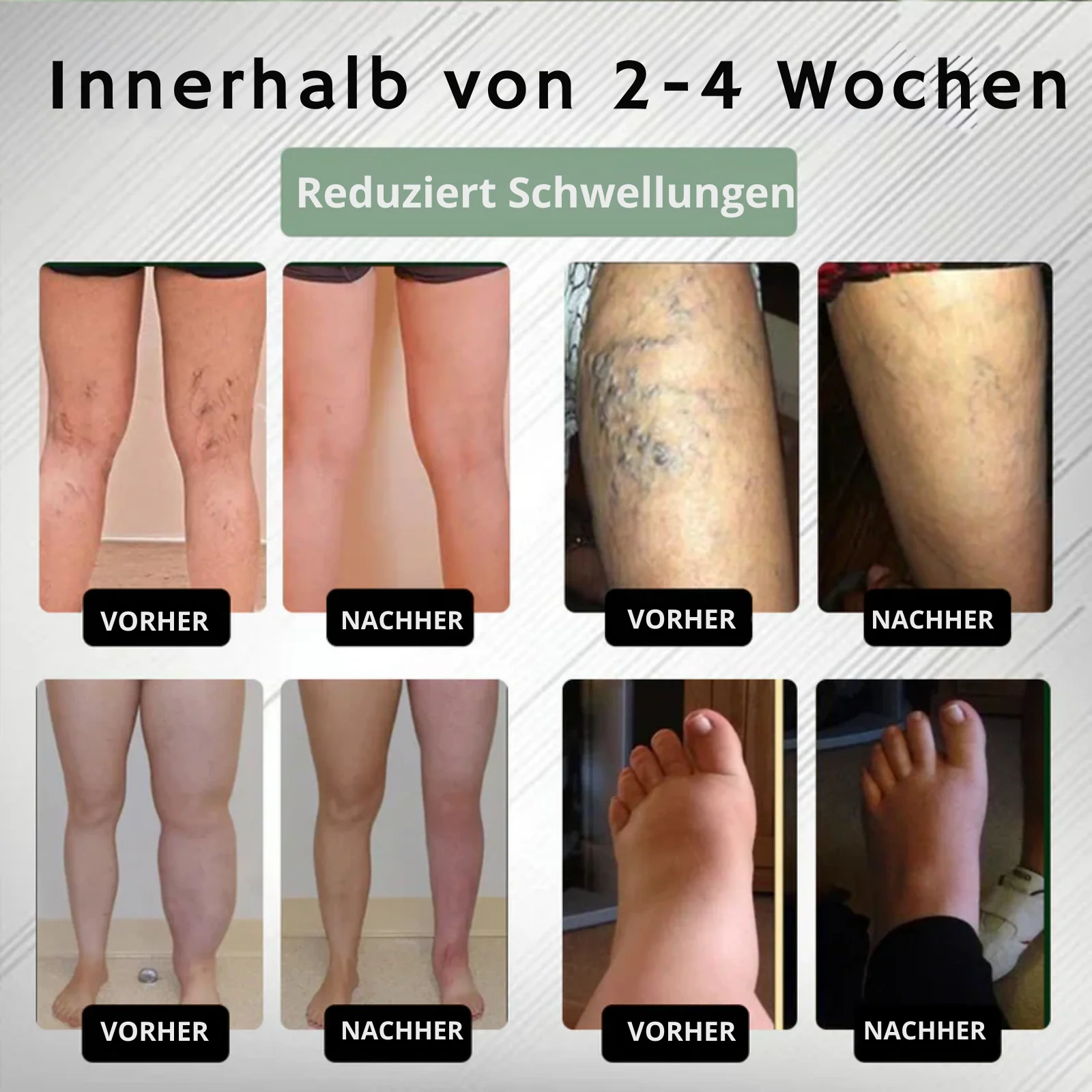 EdemaEase™ | Verabschiede dich noch heute von Schwellungen! - Image 10
