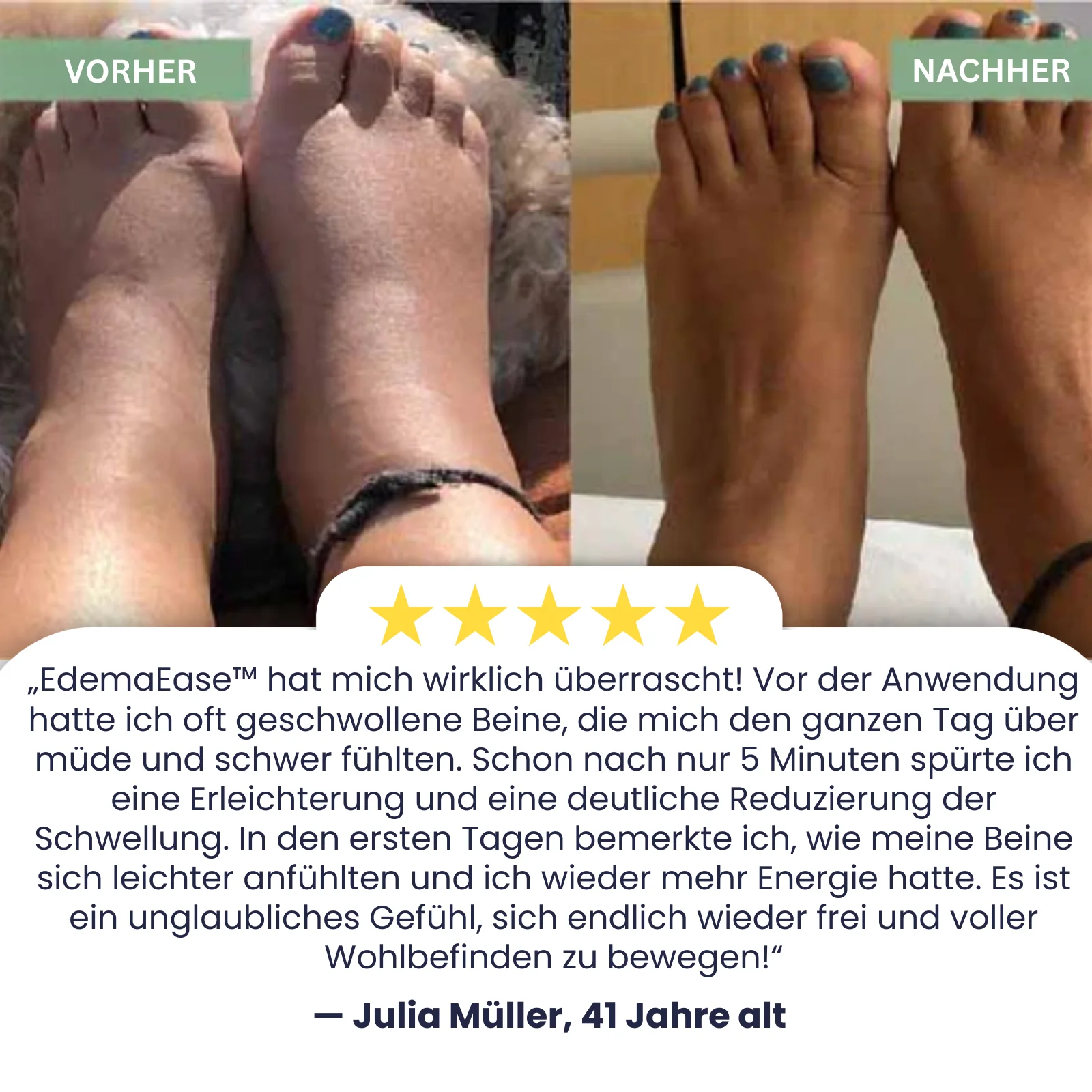 EdemaEase™ | Verabschiede dich noch heute von Schwellungen! - Image 3