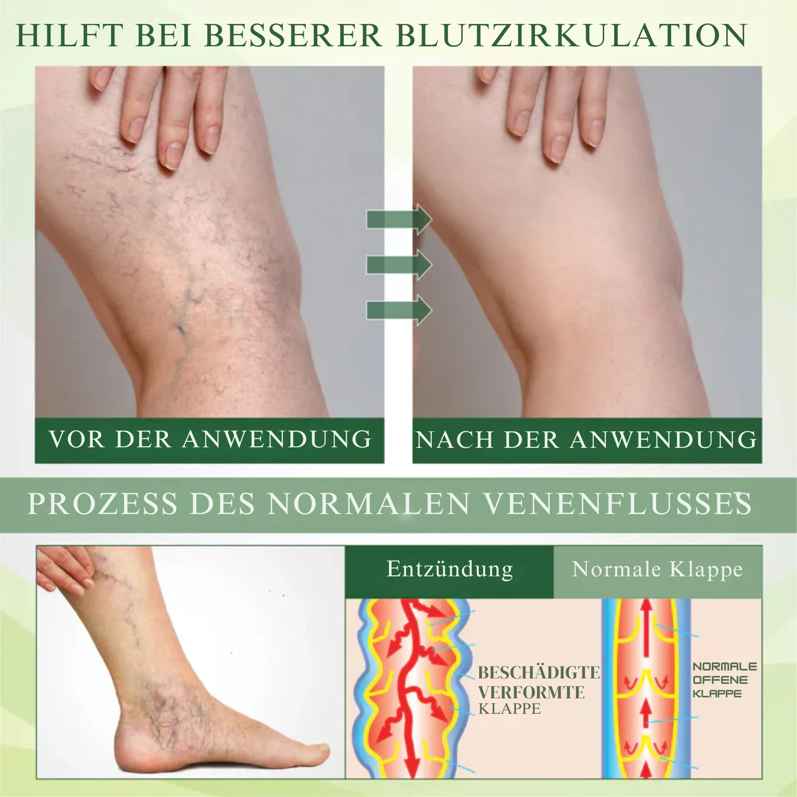 EdemaEase™ | Verabschiede dich noch heute von Schwellungen! - Image 6