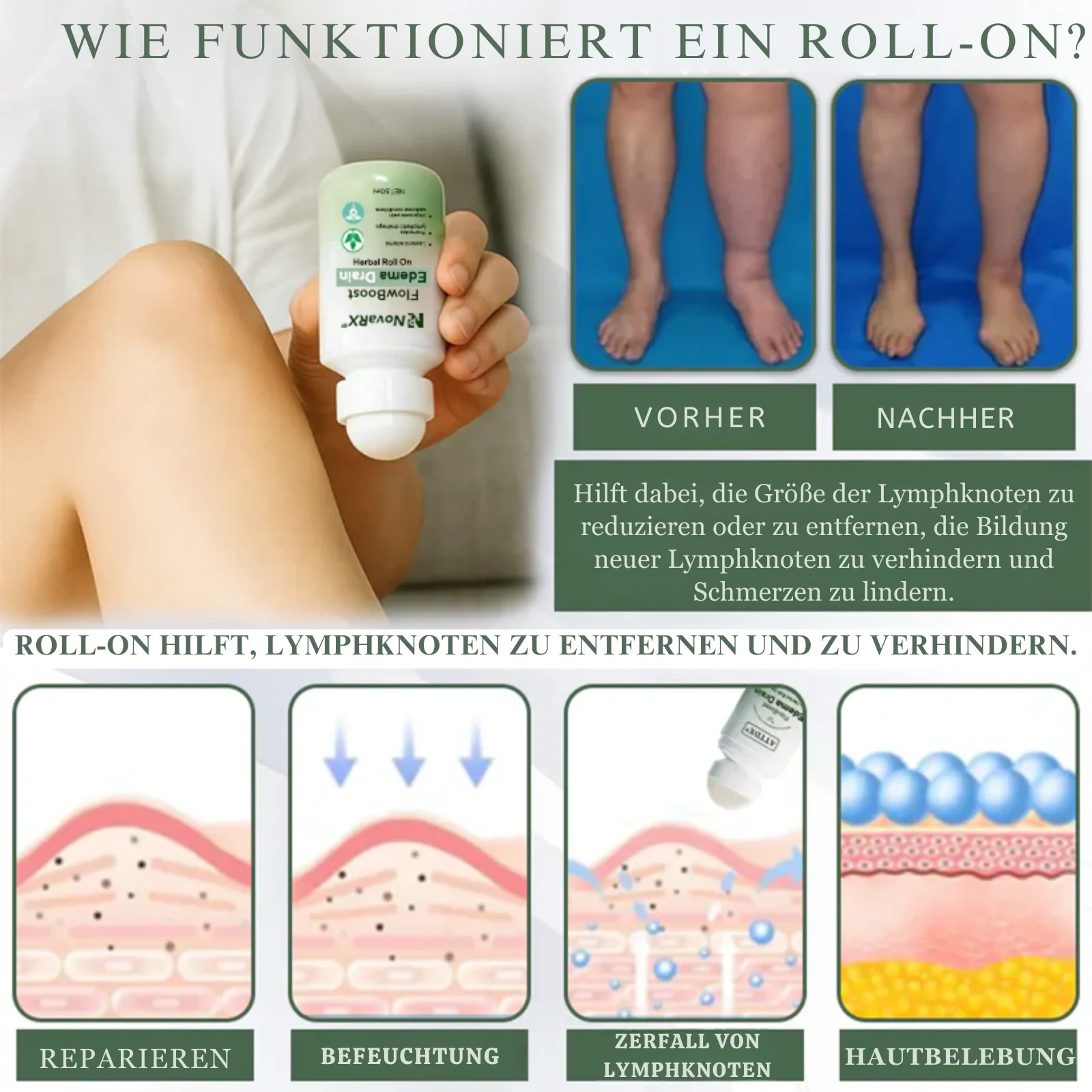 EdemaEase™ | Verabschiede dich noch heute von Schwellungen! - Image 7
