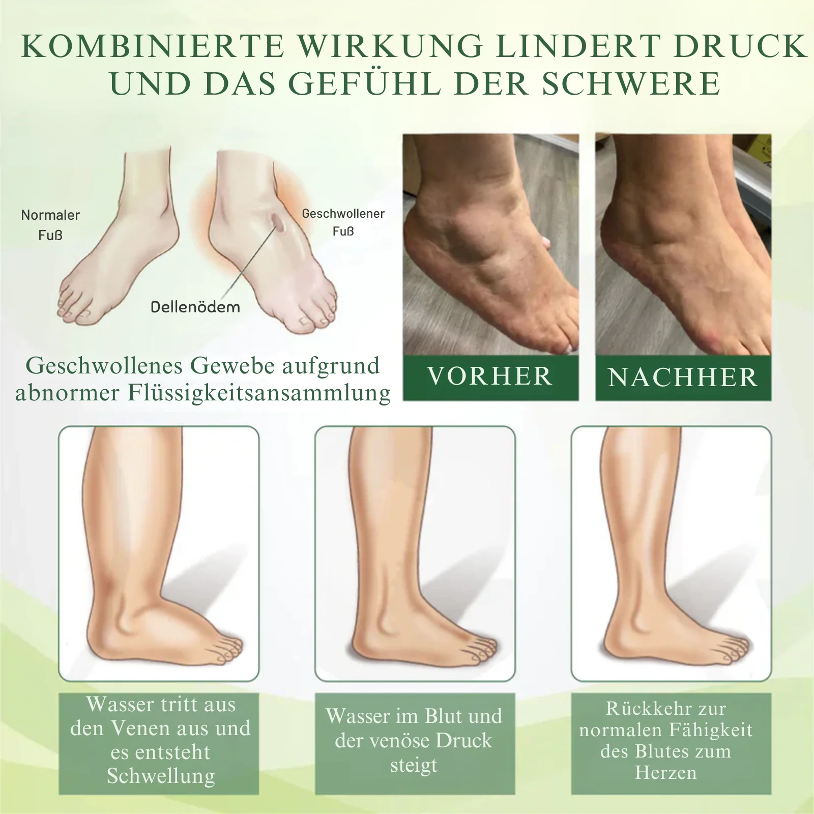 EdemaEase™ | Verabschiede dich noch heute von Schwellungen! - Image 8