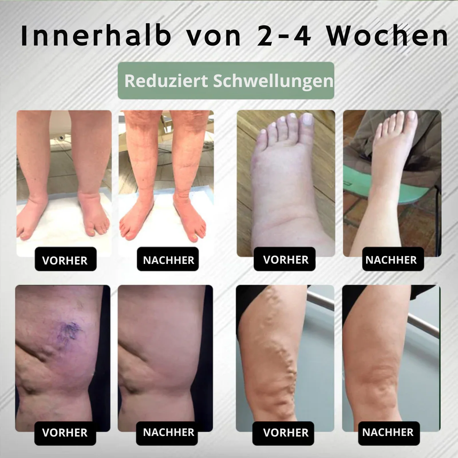 EdemaEase™ | Verabschiede dich noch heute von Schwellungen! - Image 9