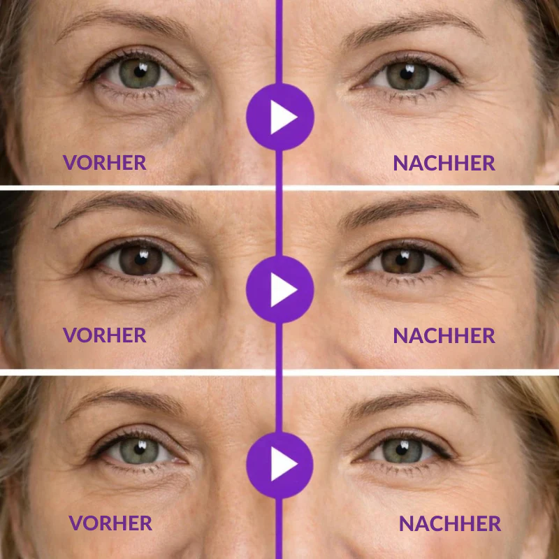 EyeBliss™ | Instant Lift Eye Gel - Image 10
