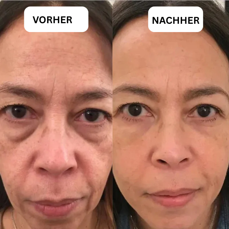 EyeBliss™ | Instant Lift Eye Gel - Image 8