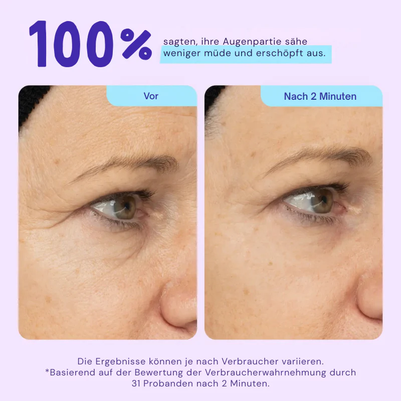 EyeBliss™ | Instant Lift Eye Gel - Image 9