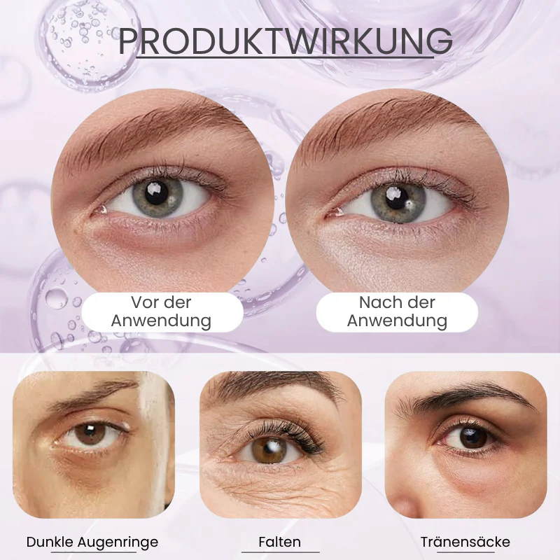 EyeLift™ | Entfernt 98 % aller Augenringe & Falten sofort! - Image 12