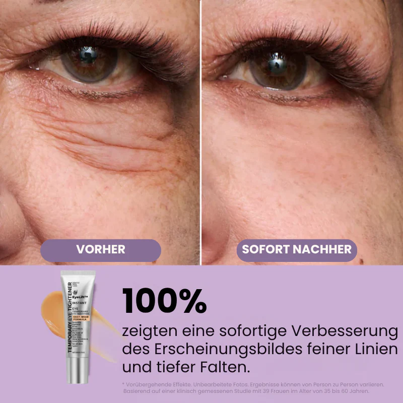 EyeLift™ | Entfernt 98 % aller Augenringe & Falten sofort! - Image 6