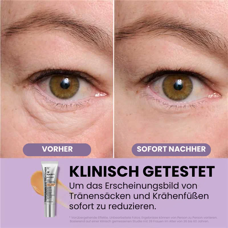 EyeLift™ | Entfernt 98 % aller Augenringe & Falten sofort! - Image 7