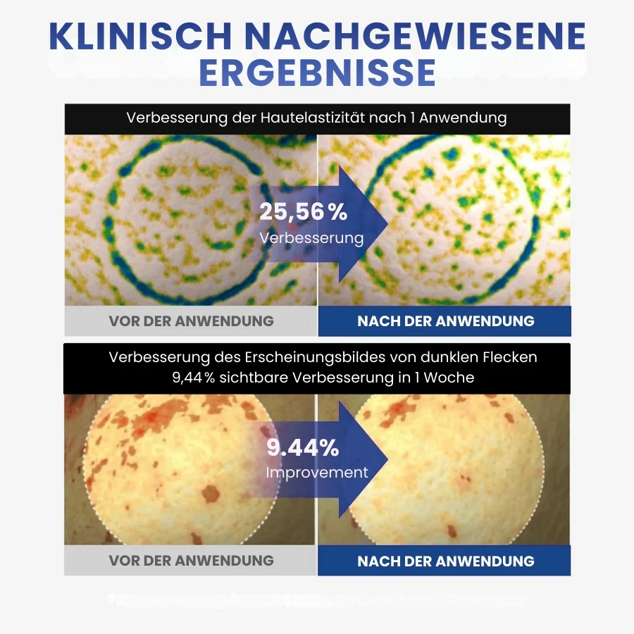 FirmSkin™ | PDRN Active Renew Creme - Image 7