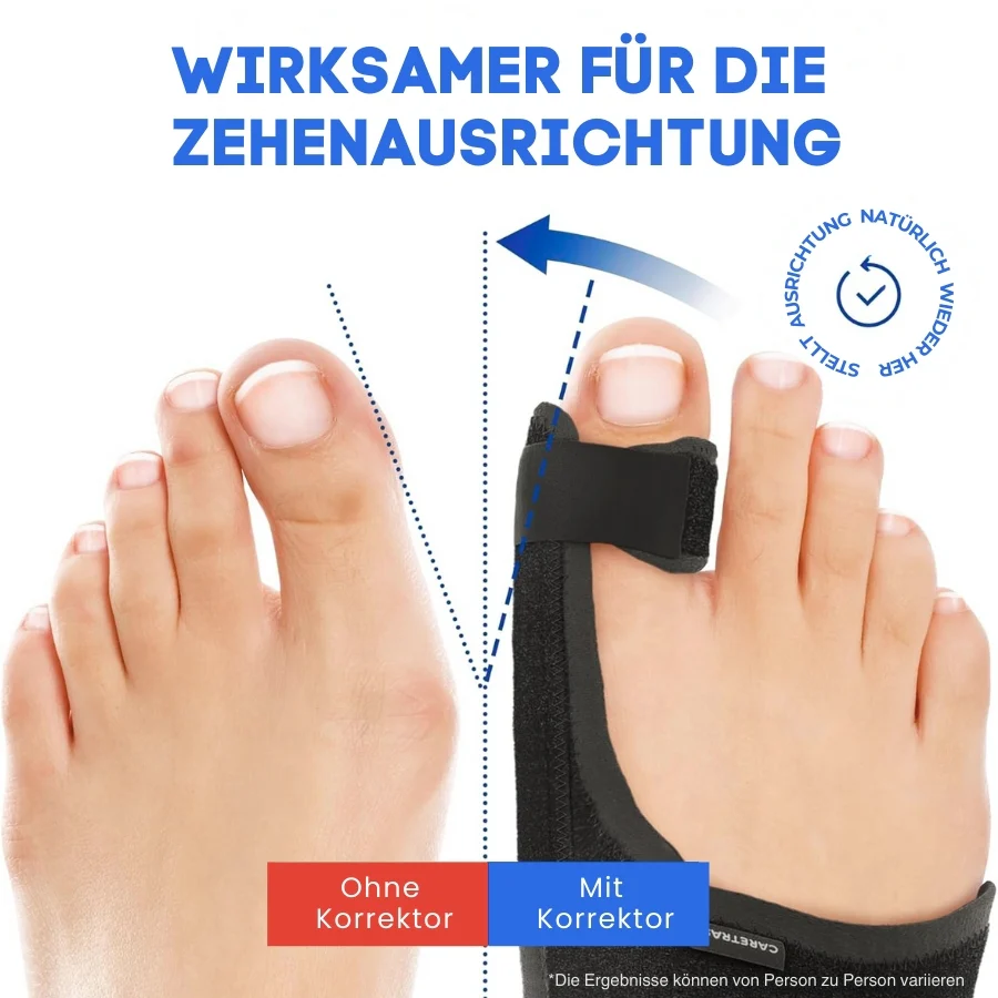 FootFlexi™ | Hallux-Valgus-Entlastungsschiene - Image 2