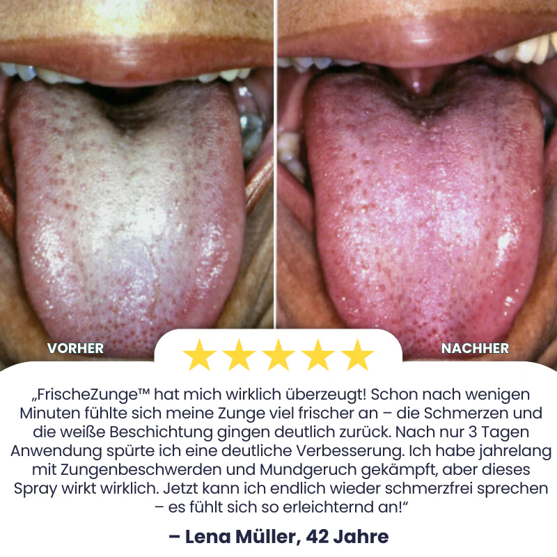FrischeZunge™ | Zungenreparatur-Spray - Image 3