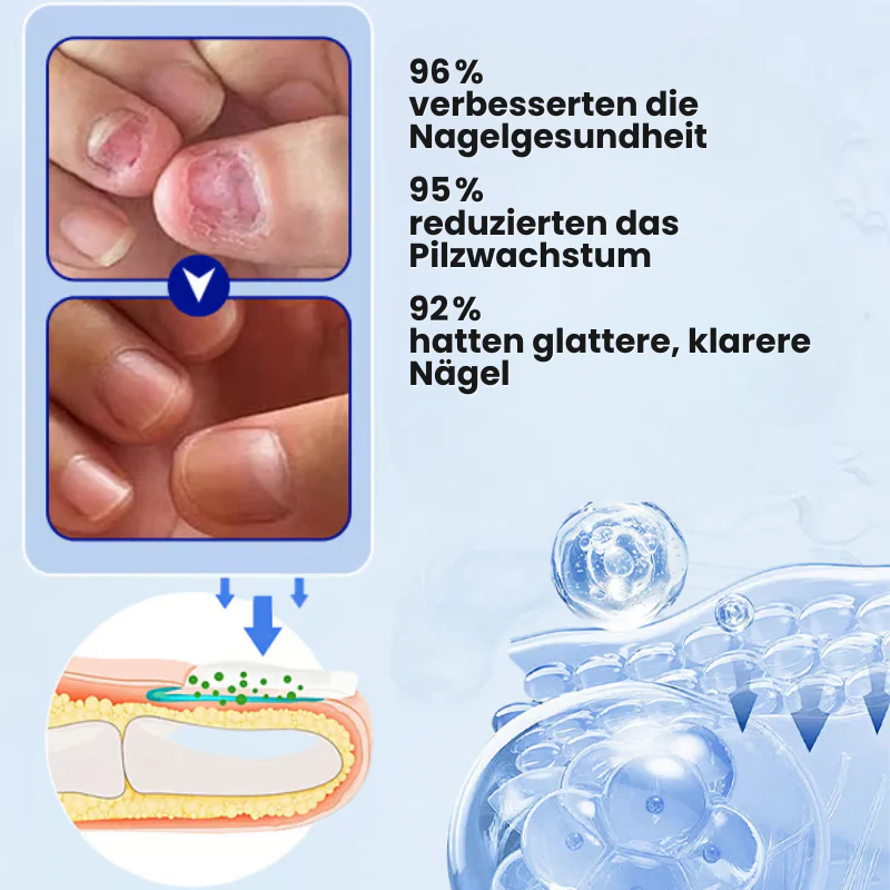 FungiPatch™ Stellen Sie gesunde Nägel ganz einfach wieder her - Image 4