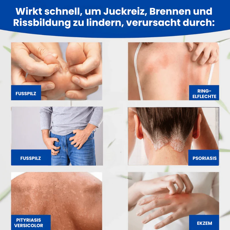 FungusFree™ | Antimykotische Creme - Image 5