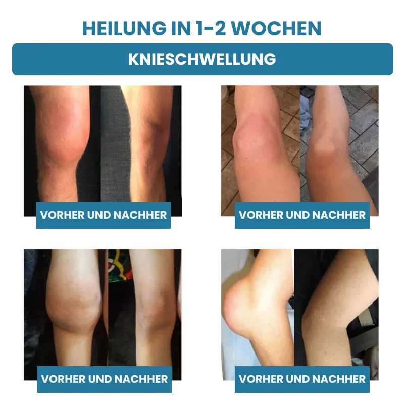 GelenkPro™ | Hyaluron-Creme gegen Gelenkschmerzen - Image 10