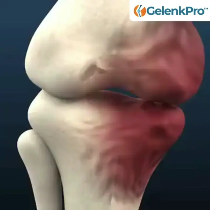 GelenkPro™ | Hyaluron-Creme gegen Gelenkschmerzen - Image 15