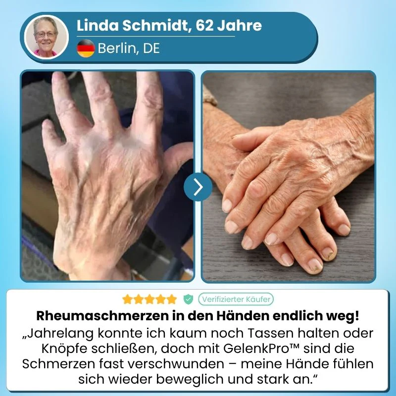 GelenkPro™ | Hyaluron-Creme gegen Gelenkschmerzen - Image 4