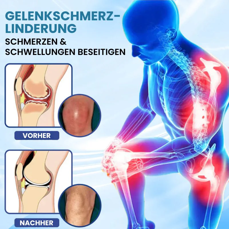 GelenkPro™ | Hyaluron-Creme gegen Gelenkschmerzen - Image 7