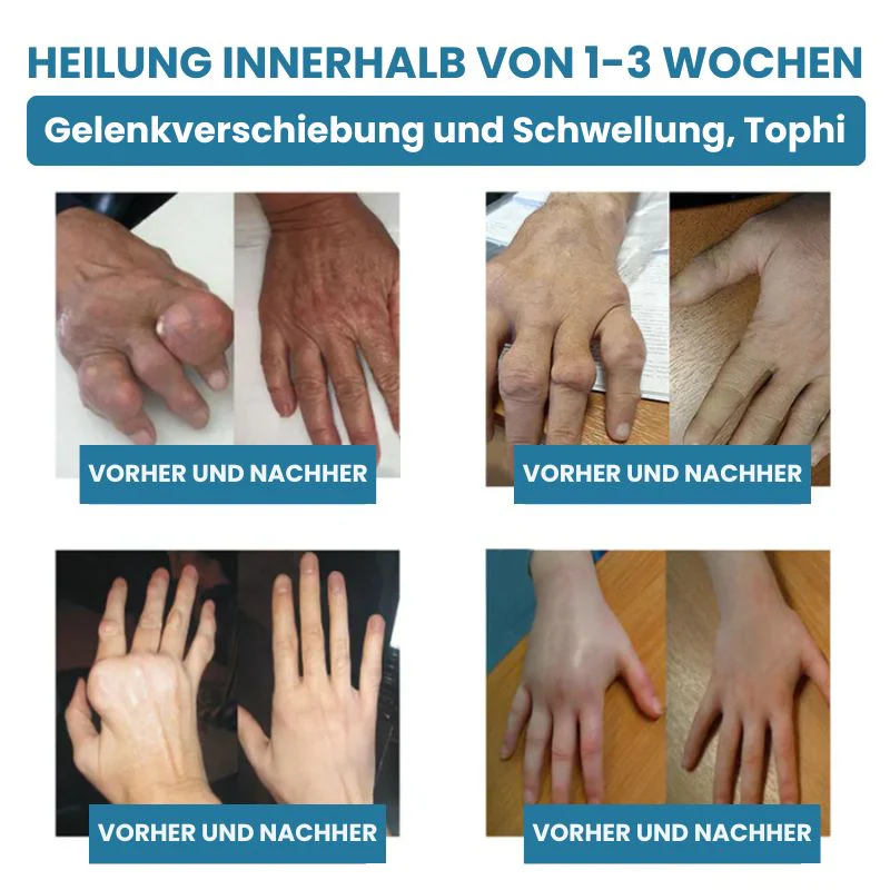 GelenkPro™ | Hyaluron-Creme gegen Gelenkschmerzen - Image 8