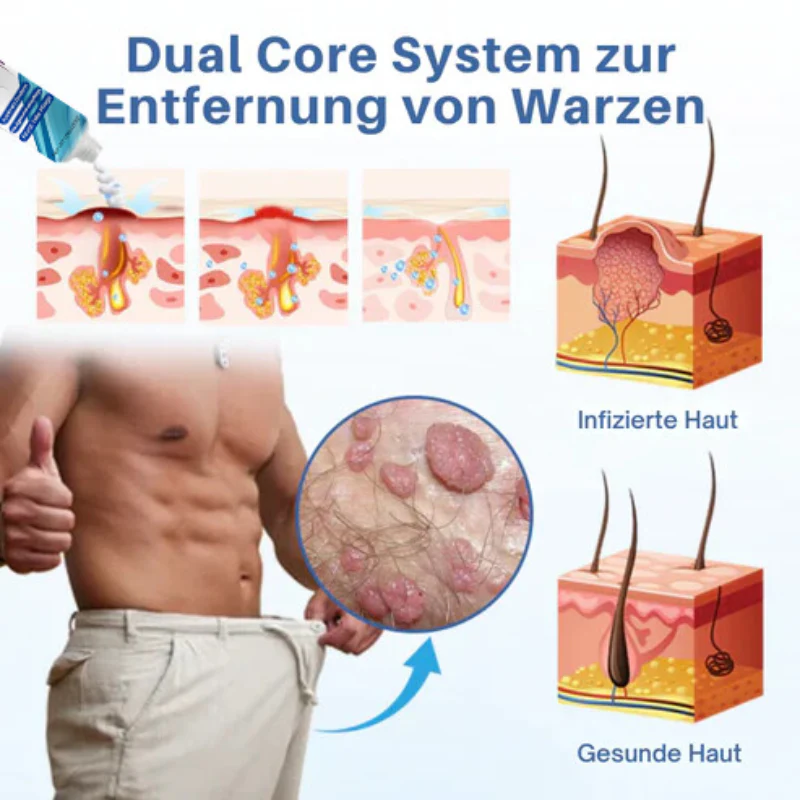 GentCare™ | Creme zur Linderung von Genitalwarzen - Image 10