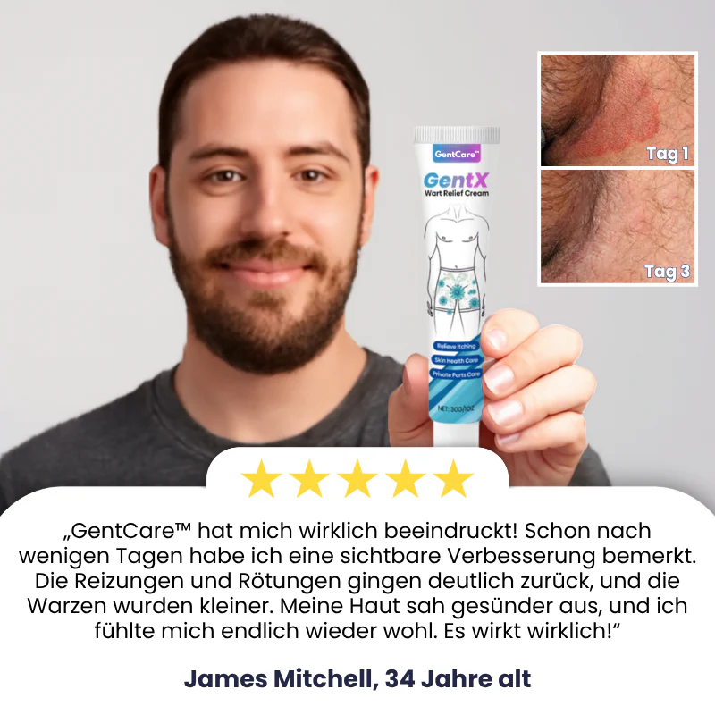 GentCare™ | Creme zur Linderung von Genitalwarzen - Image 7