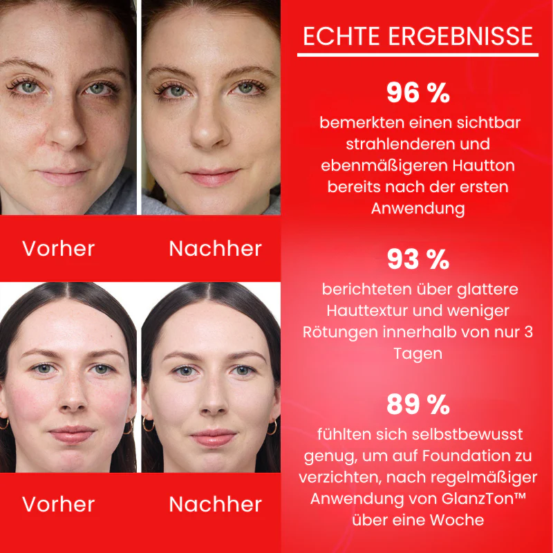 GlanzTon™ | Getönte, farbkorrigierende Gesichtscreme mit Lichtschutzfaktor (SPF) - Image 2