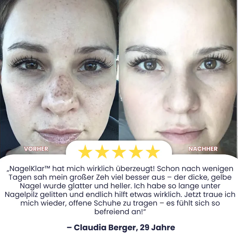 GlanzTon™ | Getönte, farbkorrigierende Gesichtscreme mit Lichtschutzfaktor (SPF) - Image 4