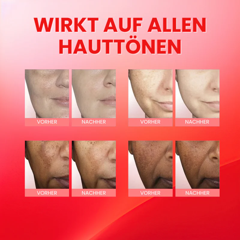 GlanzTon™ | Getönte, farbkorrigierende Gesichtscreme mit Lichtschutzfaktor (SPF) - Image 6