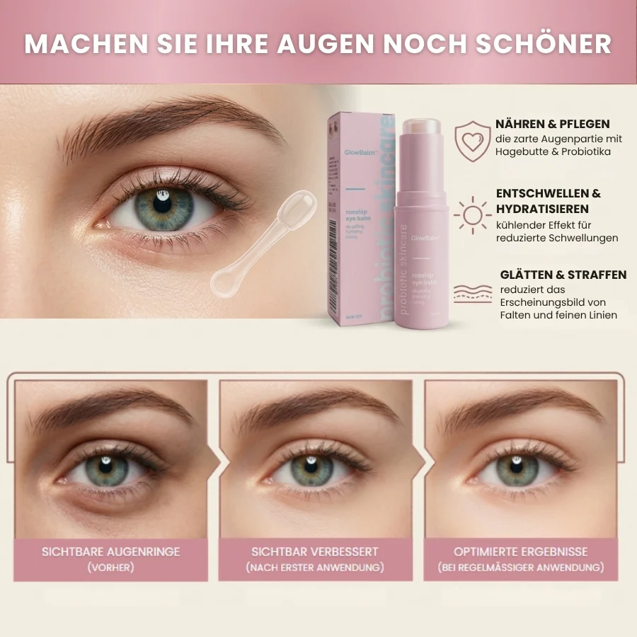 GlowBalm™ | Fortschrittlicher Augenstraffungs-Stick-Balsam - Image 7