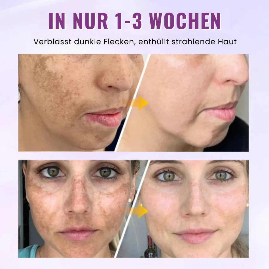 GlowGenix™ | Niacinamid Aufhellendes Sommersprossen Serum - Image 12
